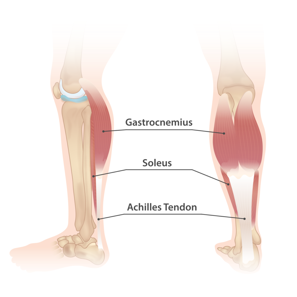 Anatomical diagram showing the gastrocnemius and soleus muscles in the lower leg